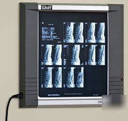 Wolf x-ray insight illuminator, standard 14