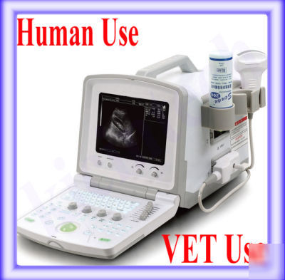 Full digital ultrasound scanner with convex probe 2 usb