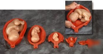 Uterus gravid professional training set 5 fetus #2807*
