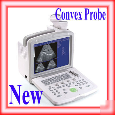 Full digital ultrasound scanner with convex probe 2 usb