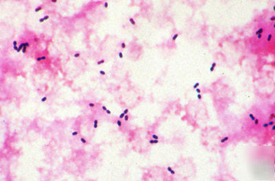 Gram staining solutions microscopy stains 4X250ML